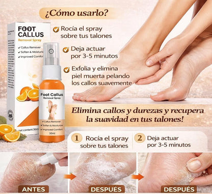 Removedor de callos ™ Foot Remove