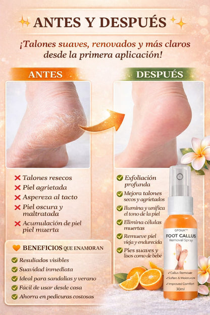 Removedor de callos ™ Foot Remove
