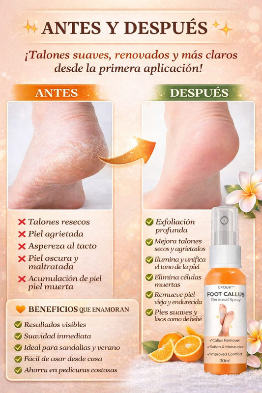 Removedor de callos ™ Foot Remove